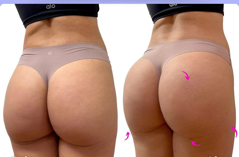 Before After