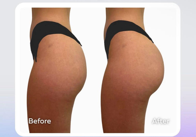 Before After