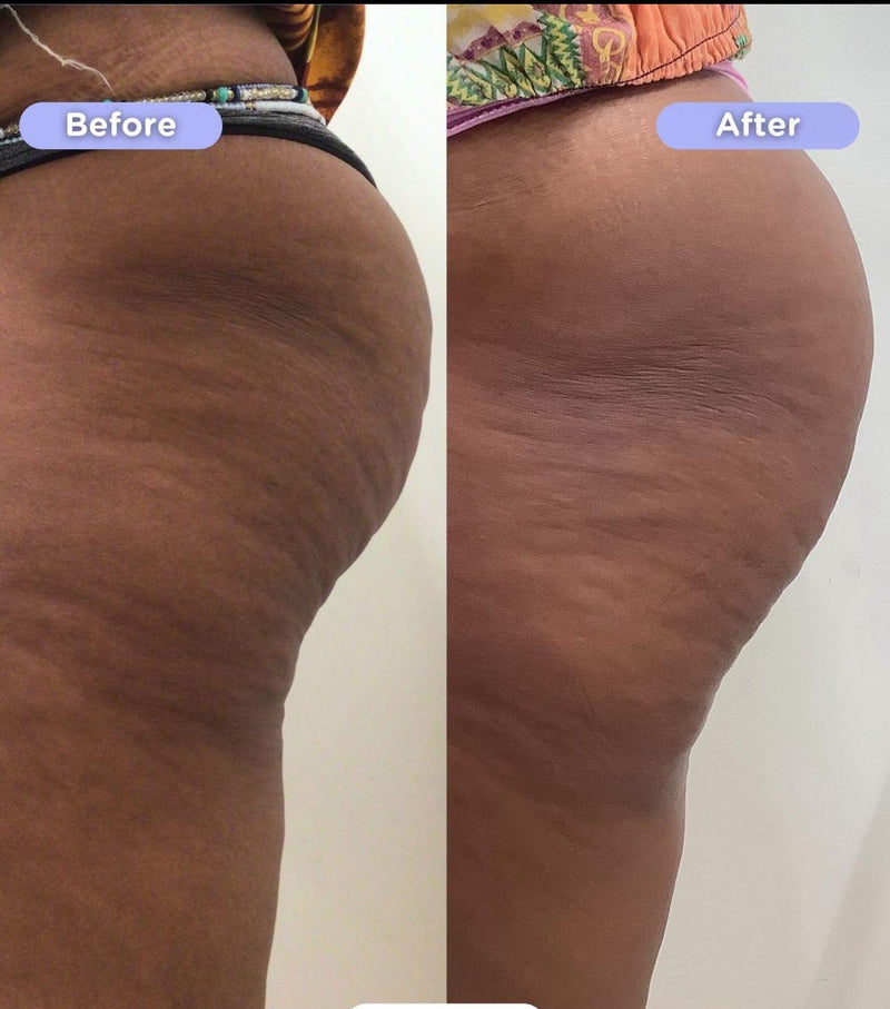 Before After