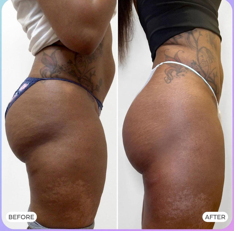 Before After