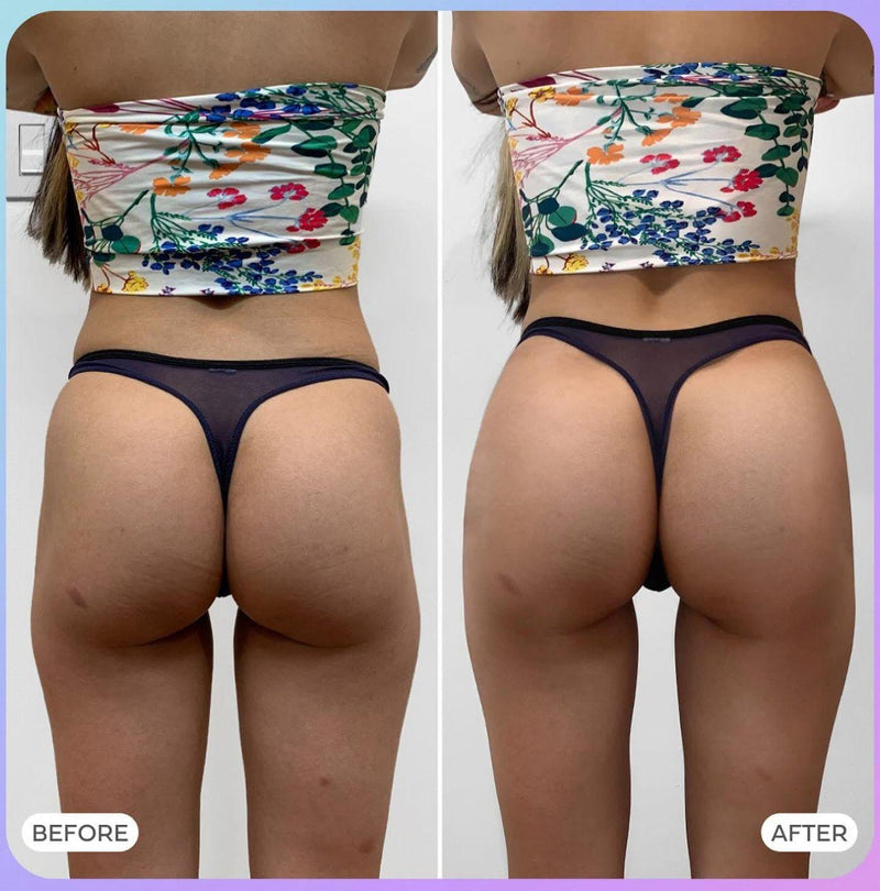 Before After