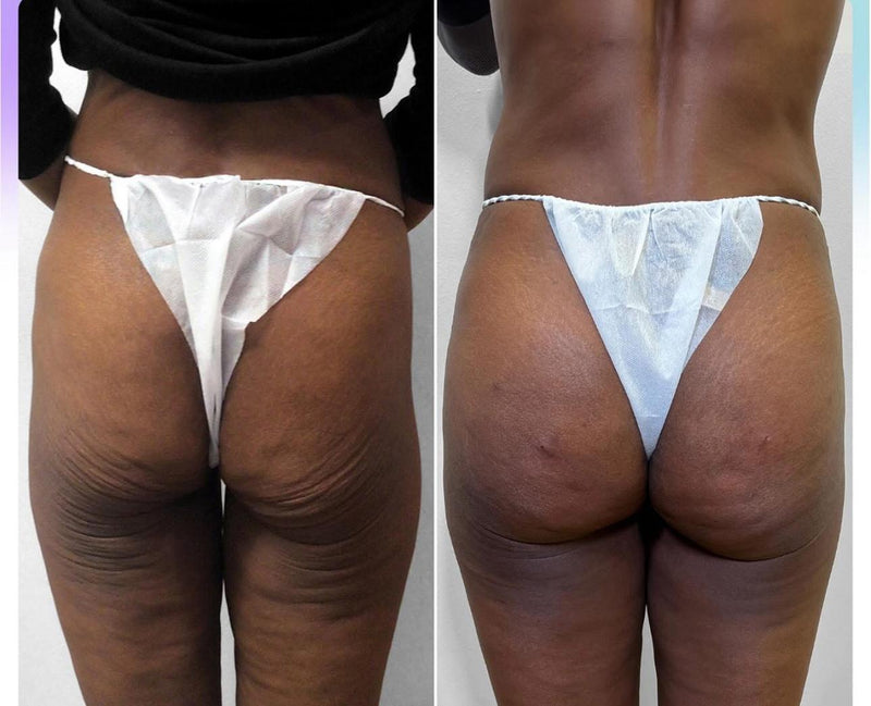 Before After