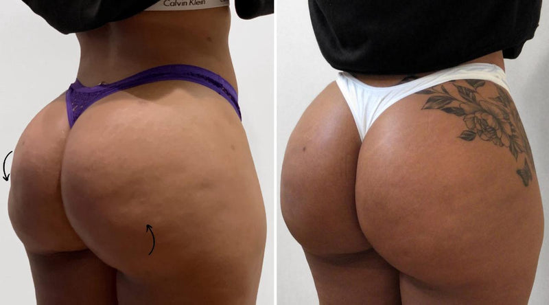 Before After